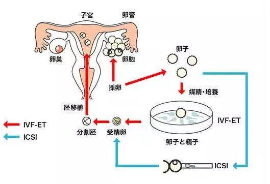 试管婴儿胚胎移植后出血常见原因及处理方法 试管婴儿流程 宝孕天使 宝孕天使